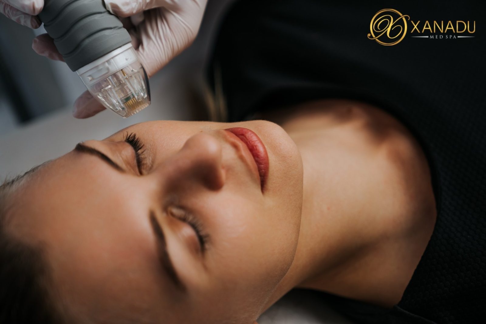 Inside the New Era of Non-Surgical Facelifts at Xanadu Med Spa: How Technology Is Replacing the Scalpel